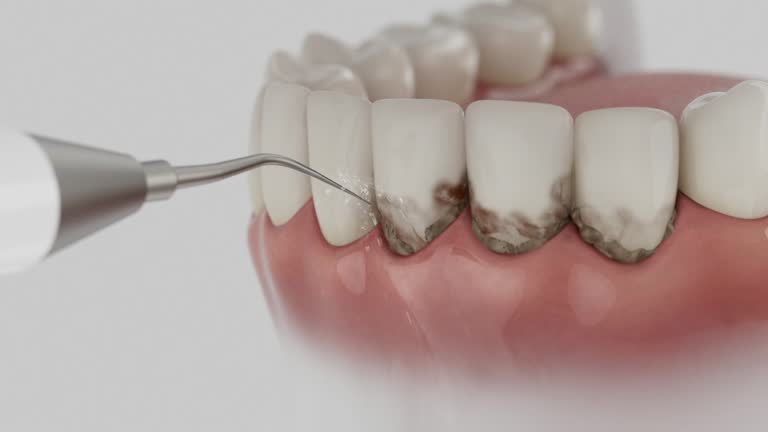 Reliable Dental contractor in Berne, IN by Dentist Open Now